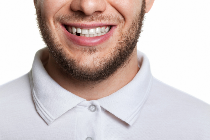 Missing Teeth Treatment