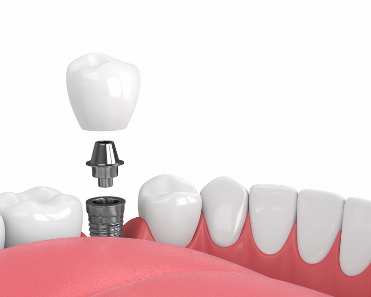 Westbourne Grove Dental